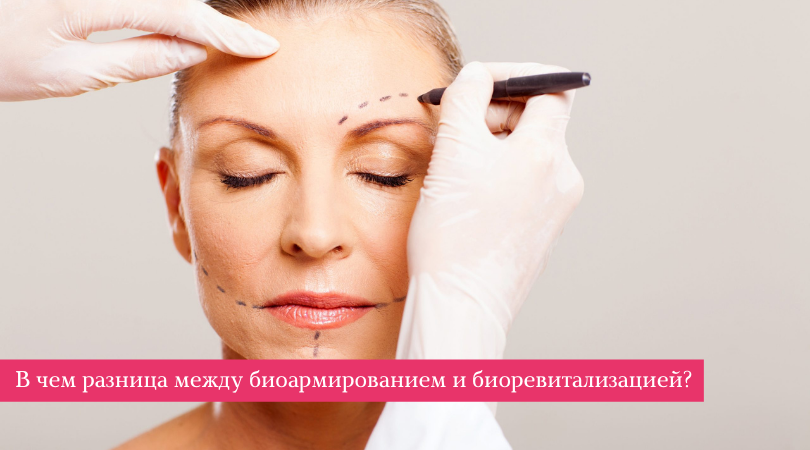 Биоармирование и биоревитализация в чем разница. 54e9177389c0fc56148e95d45f2d753c. Биоармирование и биоревитализация в чем разница фото. Биоармирование и биоревитализация в чем разница-54e9177389c0fc56148e95d45f2d753c. картинка Биоармирование и биоревитализация в чем разница. картинка 54e9177389c0fc56148e95d45f2d753c.
